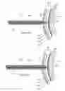 Fig. 05 - Electrosurgical pericardial puncture