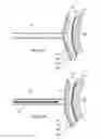 Fig. 08 - Electrosurgical pericardial puncture