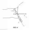 Fig. 05 - Systems and methods for detecting tissue contact during ablation