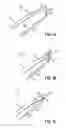 Fig. 02 - Systems and methods for treating the heart with ablation