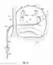 Fig. 06 - Systems and methods for treating the heart with ablation