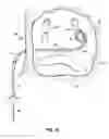 Fig. 07 - Systems and methods for treating the heart with ablation