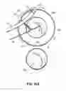 Fig. 30 - Systems and methods for treating the heart with ablation
