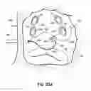 Fig. 45 - Systems and methods for treating the heart with ablation
