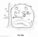Fig. 52 - Systems and methods for treating the heart with ablation