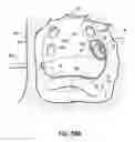 Fig. 56 - Systems and methods for treating the heart with ablation
