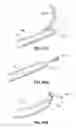 Fig. 59 - Systems and methods for treating the heart with ablation
