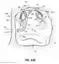 Fig. 69 - Systems and methods for treating the heart with ablation