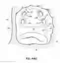 Fig. 71 - Systems and methods for treating the heart with ablation