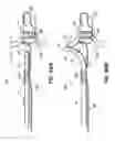 Fig. 74 - Systems and methods for treating the heart with ablation
