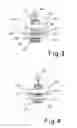 Fig. 03 - SURGICAL SYSTEM WITH STERILE WRAPPINGS