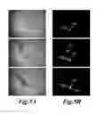 Fig. 06 - Automated surgical and interventional procedures