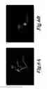 Fig. 07 - Automated surgical and interventional procedures