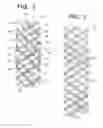 Fig. 03 - Multi-strand implant with enhanced radiopacity