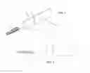 Fig. 02 - TOOTH-CLEANING DEVICE