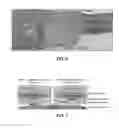 Fig. 04 - Biocompatible tissue graft