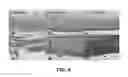 Fig. 06 - Biocompatible tissue graft