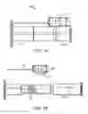 Fig. 02 - Implant loading device and system