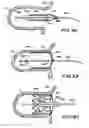 Fig. 13 - Filter apparatus for ostium of left atrial appendage