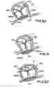 Fig. 17 - Filter apparatus for ostium of left atrial appendage