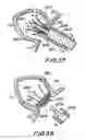 Fig. 19 - Filter apparatus for ostium of left atrial appendage