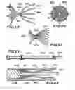 Fig. 20 - Filter apparatus for ostium of left atrial appendage