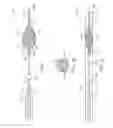 Fig. 02 - Embolic protection device