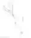 Fig. 20 - Bariatric sleeve