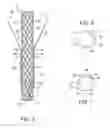 Fig. 04 - Anti-leakage prosthesis