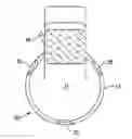 Fig. 01 - RESILIENT MEDICALLY INFLATABLE INTERPOSITIONAL ARTHROPLASTY DEVICE