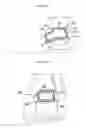 Fig. 12 - RESILIENT MEDICALLY INFLATABLE INTERPOSITIONAL ARTHROPLASTY DEVICE