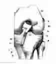 Fig. 01 - LIGAMENT FIXTURE