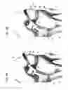Fig. 05 - LIGAMENT FIXTURE