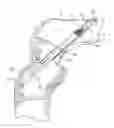 Fig. 01 - Implantable biologic holder