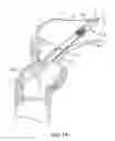 Fig. 02 - Implantable biologic holder