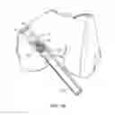 Fig. 03 - Implantable biologic holder