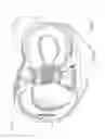 Fig. 07 - Implantable biologic holder