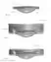 Fig. 06 - Accommodating intraocular lens