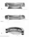 Fig. 07 - Accommodating intraocular lens