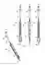 Fig. 02 - ADVANCED PUSHROD AND PUSHROD ASSEMBLY FEATURES