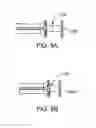 Fig. 09 - Nasal implants and systems and method of use