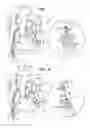 Fig. 02 - Techniques for guide-wire based advancement of artificial chordae