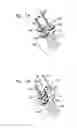 Fig. 11 - Techniques for guide-wire based advancement of artificial chordae