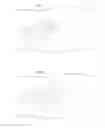 Fig. 03 - Hip joint device and method