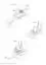 Fig. 20 - Hip joint device and method