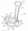 Fig. 01 - Methods for augmenting a tibial component of a knee joint prosthesis