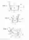 Fig. 03 - Methods for augmenting a tibial component of a knee joint prosthesis