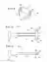 Fig. 06 - Methods for augmenting a tibial component of a knee joint prosthesis
