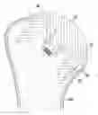 Fig. 01 - Stemless humeral component of an orthopaedic shoulder prosthesis