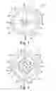 Fig. 03 - Stemless humeral component of an orthopaedic shoulder prosthesis